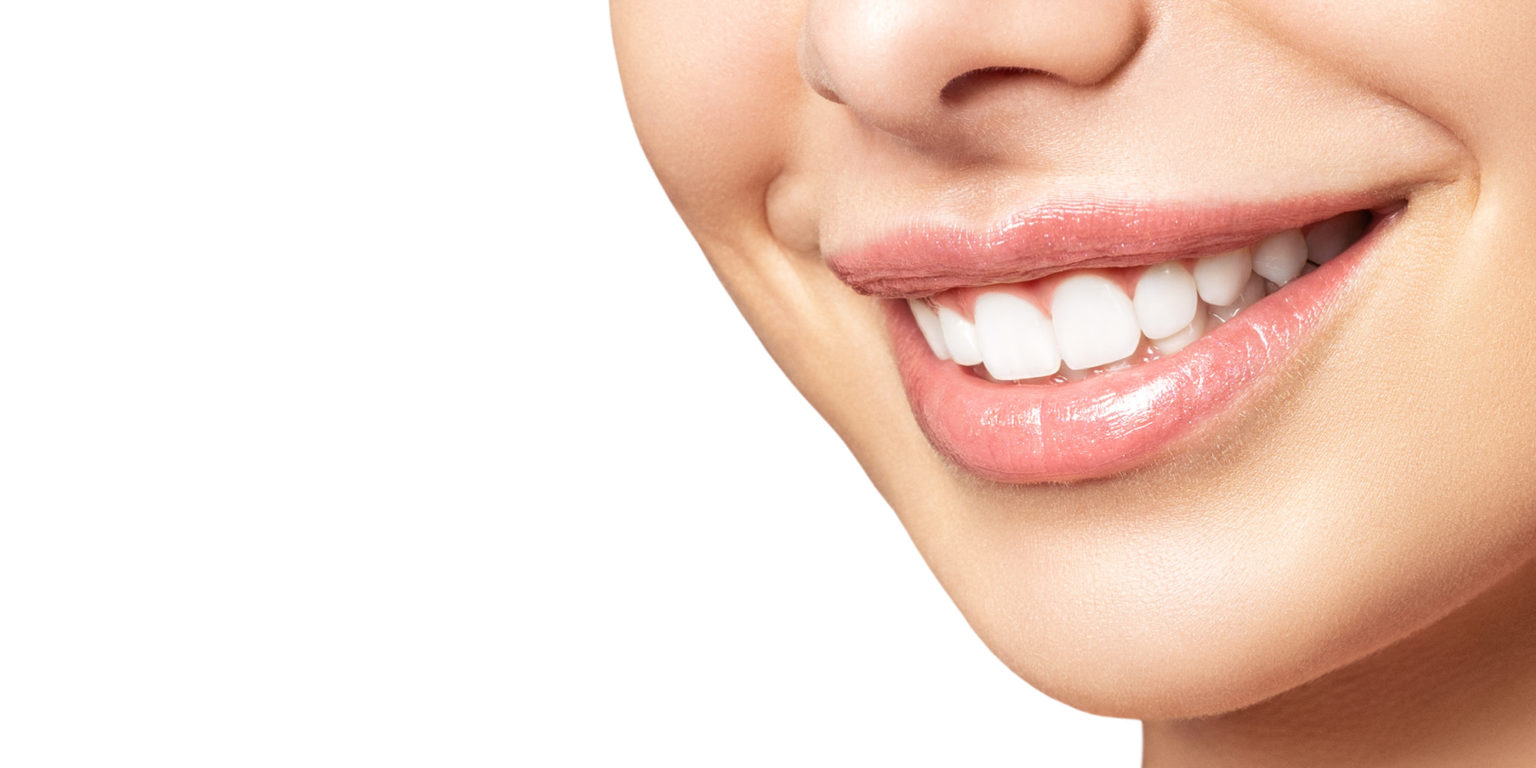 Teeth Whitening Denver, NC Avason Family Dentistry