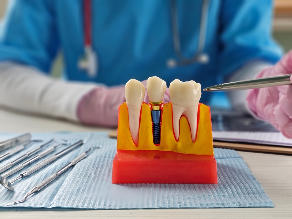 A dentist in blue scrubs and pink gloves points to a dental model displaying natural teeth plus a dental implant, with dental tools neatly set out on a blue mat in the foreground like items on a dashboard.