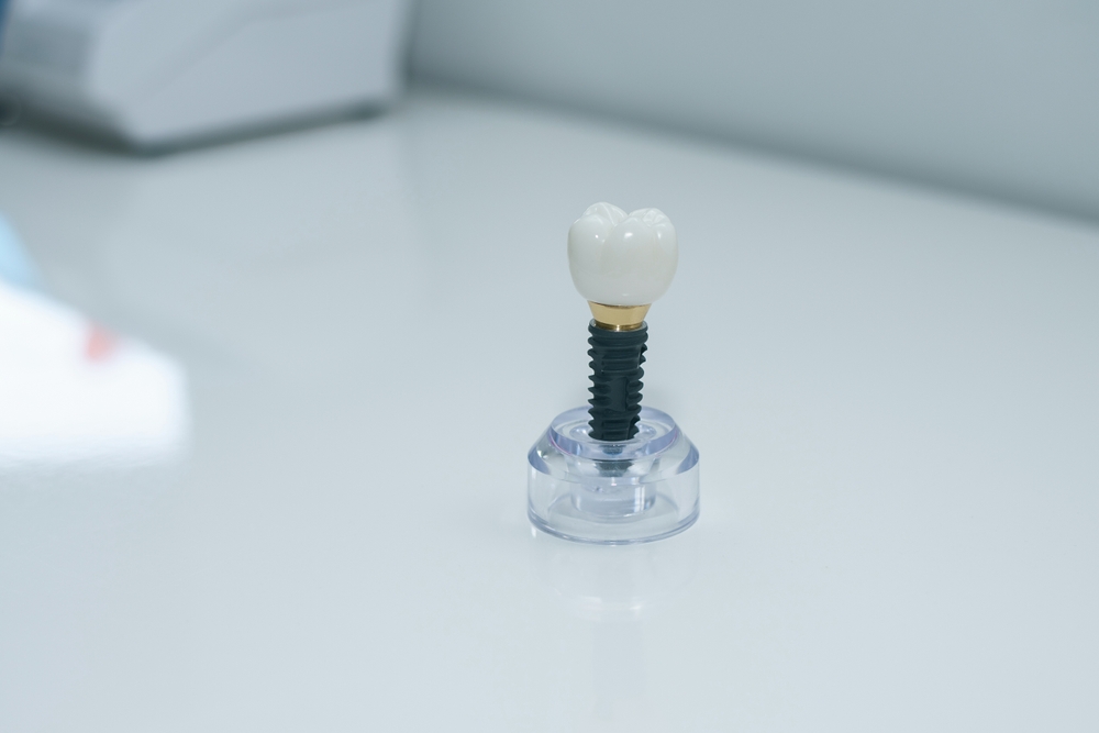 Dentist consulting patient on dental implants vs dentures.